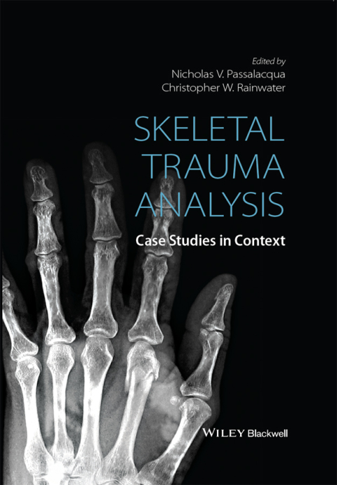 Cover image for book Skeletal Trauma Analysis