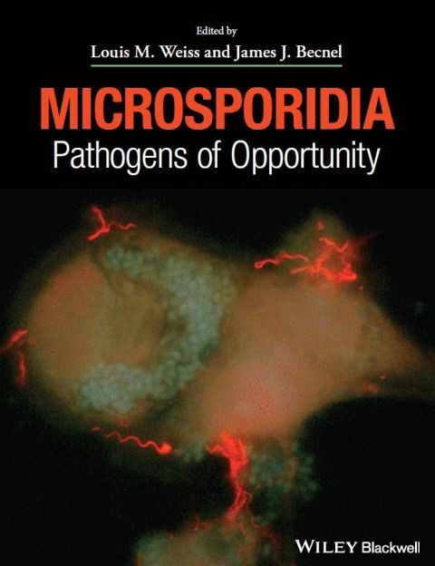 Microsporidia: Pathogens of Opportunity 