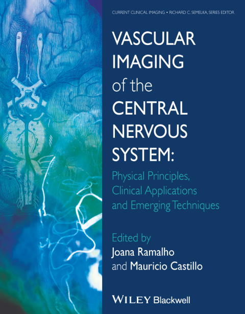 Cover image for book Vascular Imaging of the Central Nervous System
