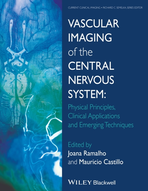 Cover image for book Vascular Imaging of the Central Nervous System