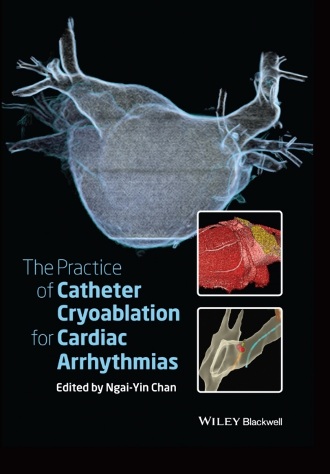 Cover image for book The Practice of Catheter Cryoablation for Cardiac Arrhythmias