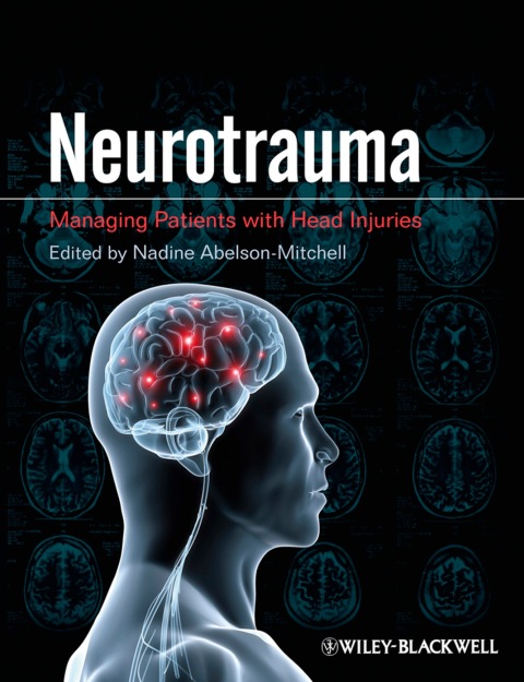 Cover image for book Neurotrauma: Managing Patients with Head Injury