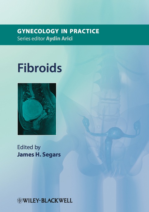 Cover image for book Fibroids
