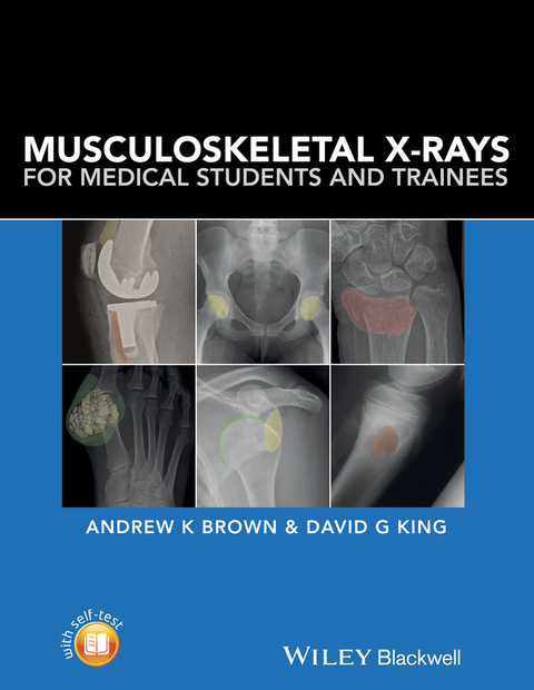 Musculoskeletal X-Rays for Medical Students and Trainees 