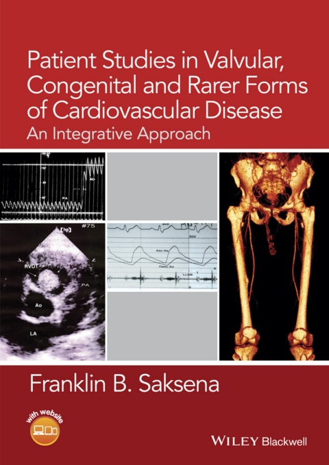 Cover image for book Patient Studies in Valvular, Congenital, and Rarer Forms of Cardiovascular Disease