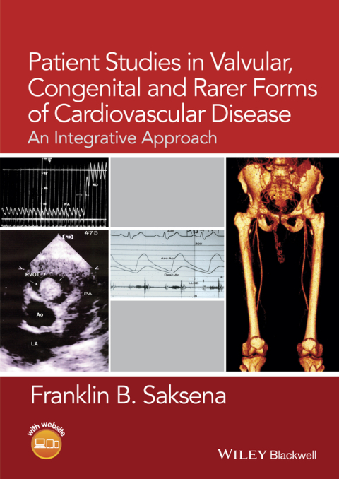 Cover image for book Patient Studies in Valvular, Congenital, and Rarer Forms of Cardiovascular Disease