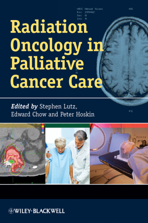 Cover image for book Radiation Oncology in Palliative Cancer Care