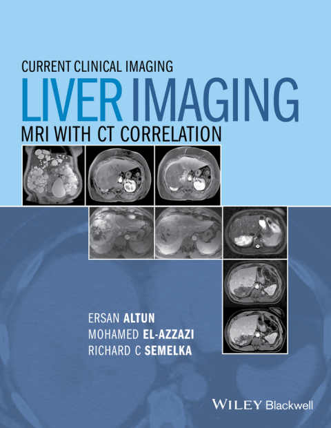 Cover image for book Liver Imaging: MRI with CT Correlation