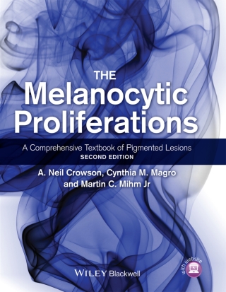 The Melanocytic Proliferations