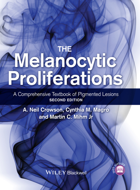 The Melanocytic Proliferations 