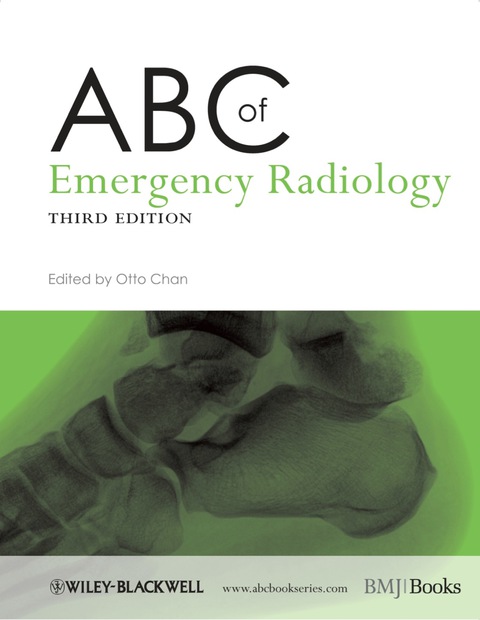 Cover image for book ABC of Emergency Radiology
