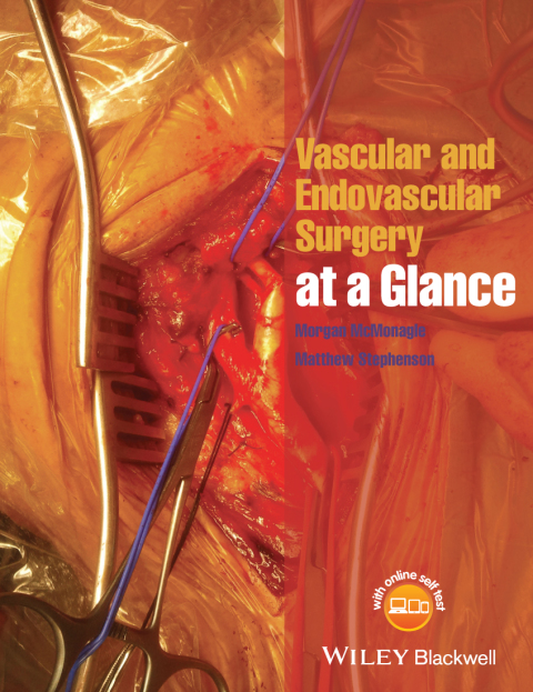 Cover image for book Vascular and Endovascular Surgery at a Glance