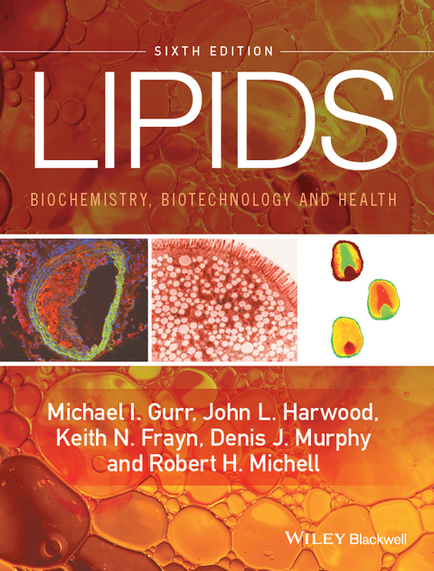 Lipids: Biochemistry, Biotechnology and Health 