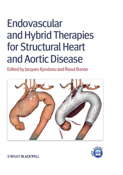 Cover image for book Endovascular and Hybrid Therapies for Structural Heart and Aortic Disease