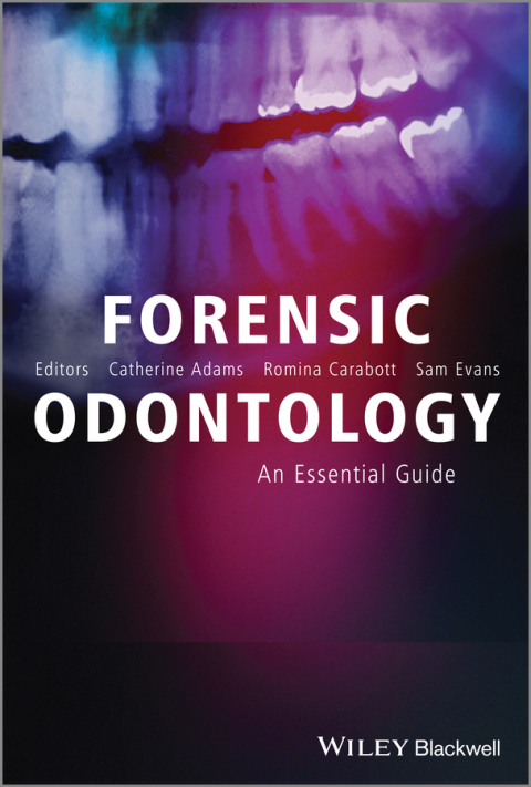Cover image for book Forensic Odontology