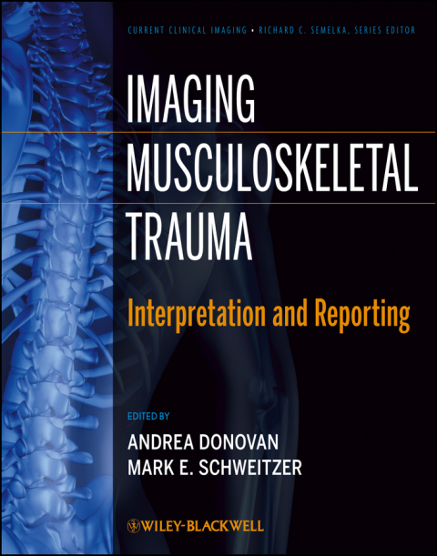 Cover image for book Imaging Musculoskeletal Trauma: Interpretation and Reporting