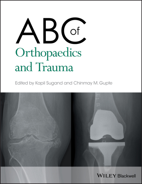 Cover image for book ABC of Orthopaedics and Trauma
