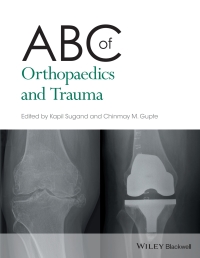ABC OF ORTHOPAEDICS AND TRAUMA