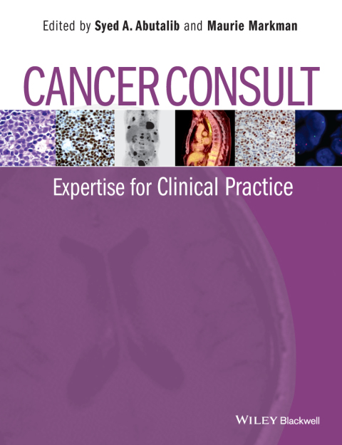 Cover image for book Cancer Consult