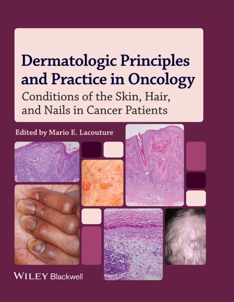 Dermatologic Principles and Practice in Oncology 
