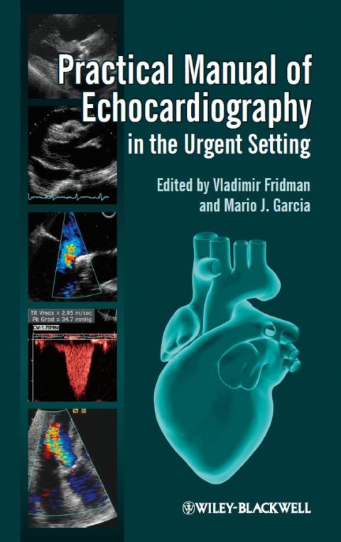 Cover image for book Practical Manual of Echocardiography in the Urgent Setting