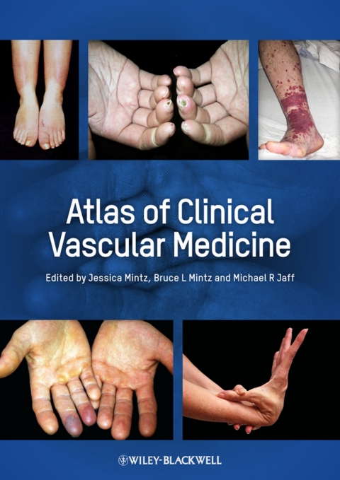 Cover image for book Atlas of Clinical Vascular Medicine