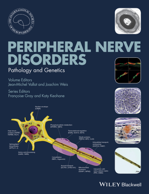 Cover image for book Peripheral Nerve Disorders