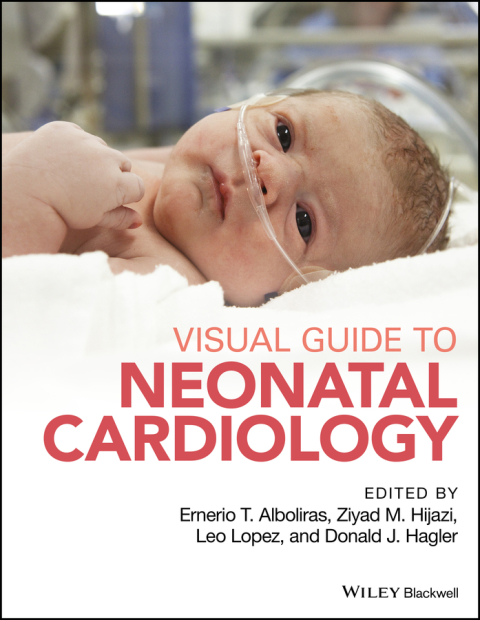 Cover image for book Visual Guide to Neonatal Cardiology