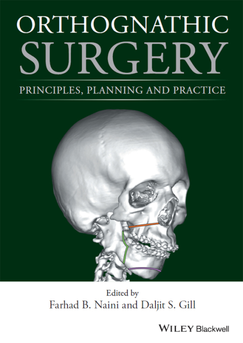 Cover image for book Orthognathic Surgery