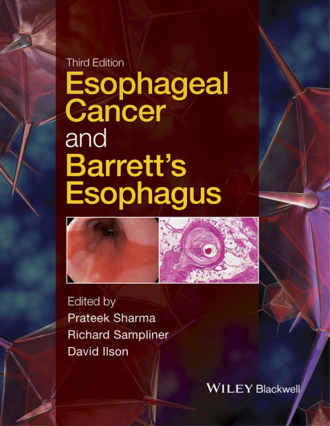 Cover image for book Esophageal Cancer and Barrett's Esophagus