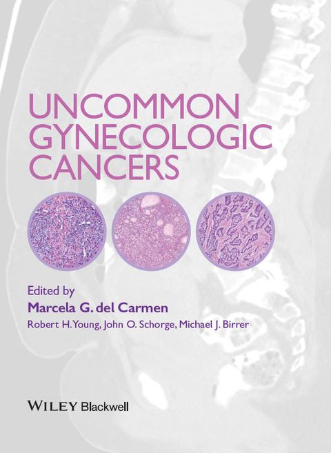 Cover image for book Uncommon Gynecologic Cancers