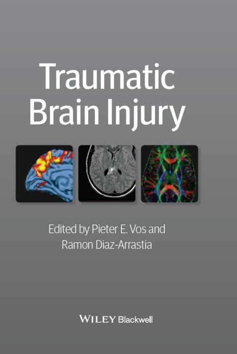 Cover image for book Traumatic Brain Injury