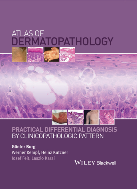 Cover image for book Atlas of Dermatopathology: Practical Differential Diagnosis by Clinicopathologic Pattern