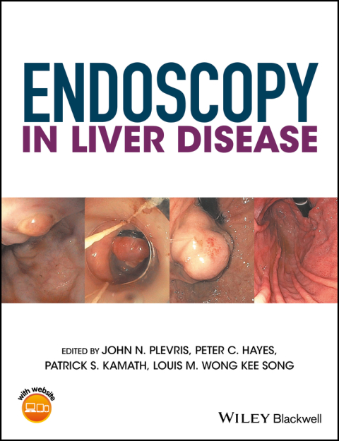 Endoscopy in Liver Disease 
