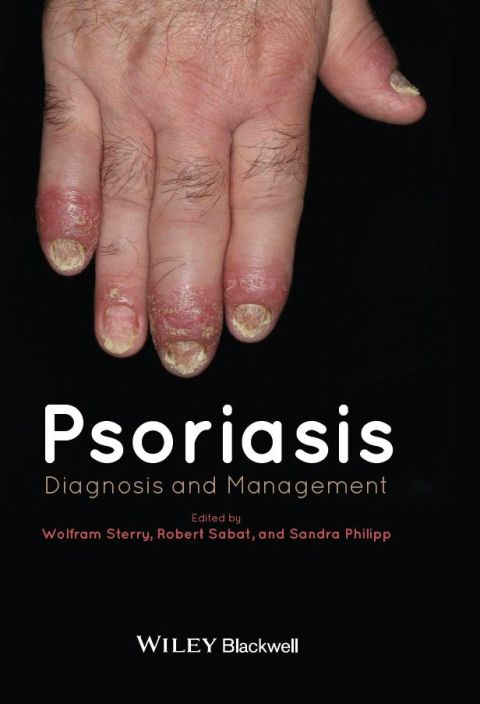 Cover image for book Psoriasis