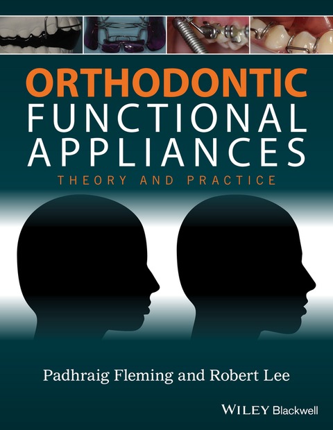 Orthodontic Functional Appliances: Theory and Practice 