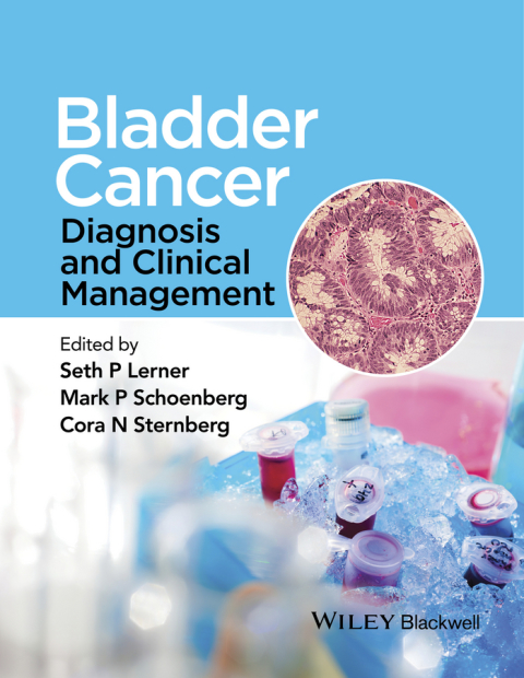 Cover image for book Bladder Cancer