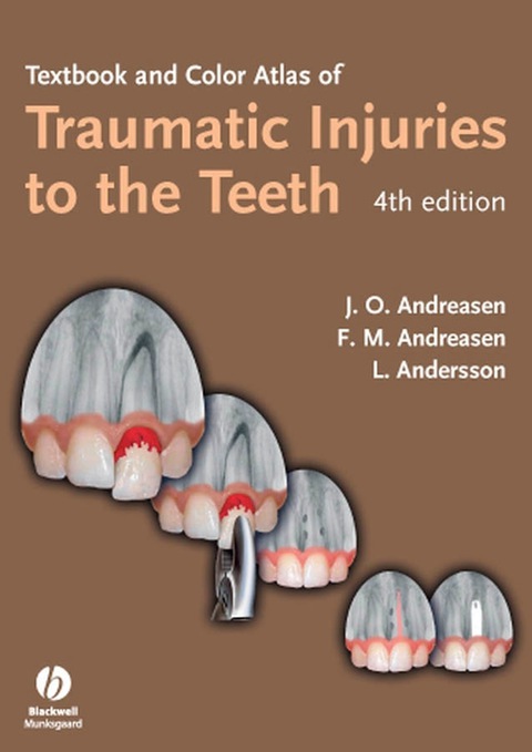 Textbook and Color Atlas of Traumatic Injuries to the Teeth 