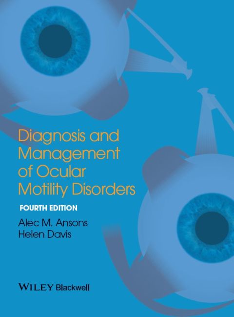 Cover image for book Diagnosis and Management of Ocular Motility Disorders
