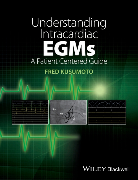 Cover image for book Understanding Intracardiac EGMs