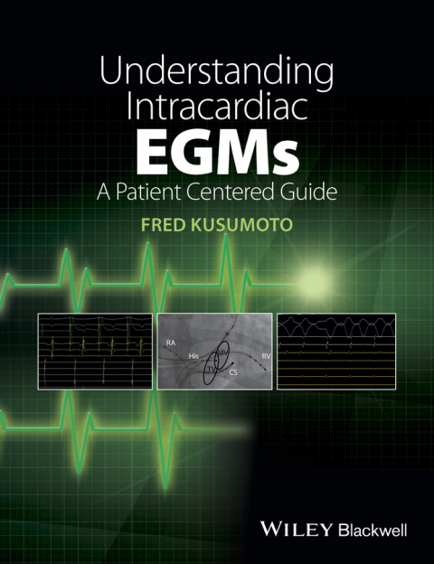 Cover image for book Understanding Intracardiac EGMs