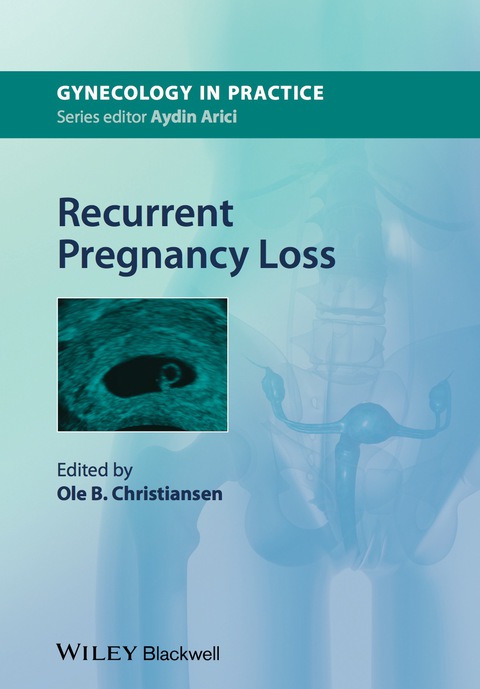 Cover image for book Recurrent Pregnancy Loss