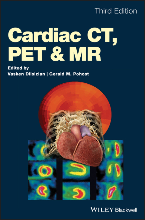 Cover image for book Cardiac CT, PET and MR