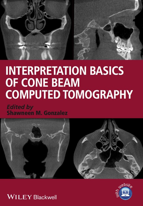 Cover image for book Interpretation Basics of Cone Beam Computed Tomography