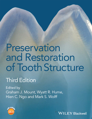 Preservation and Restoration of Tooth Structure