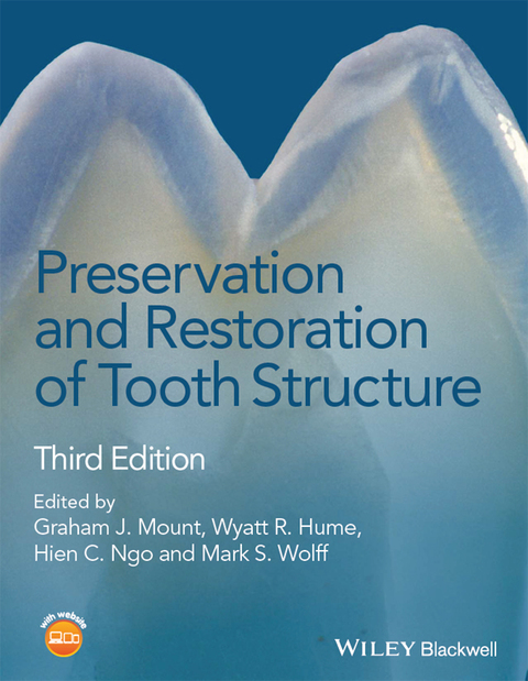 Preservation and Restoration of Tooth Structure 
