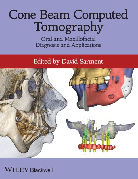 Cover image for book Cone Beam Computed Tomography