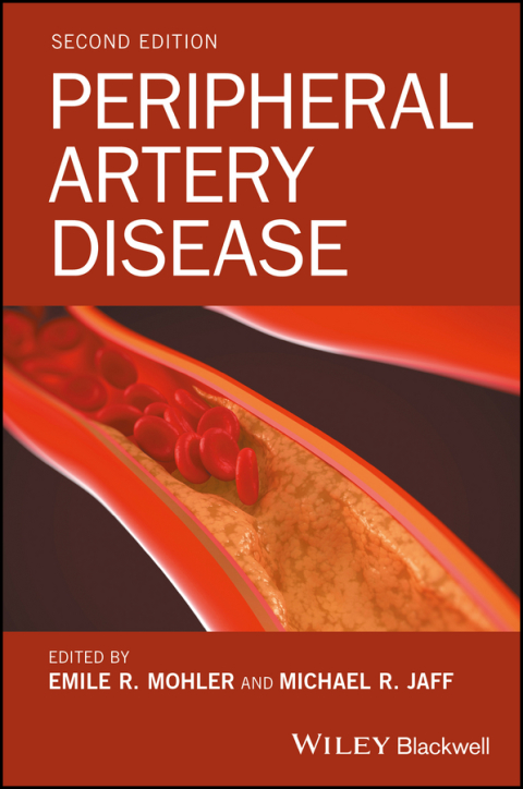 Cover image for book Peripheral Artery Disease