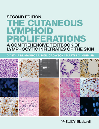 The Cutaneous Lymphoid Proliferations: A Comprehensive Textbook of Lymphocytic Infiltrates of the Skin