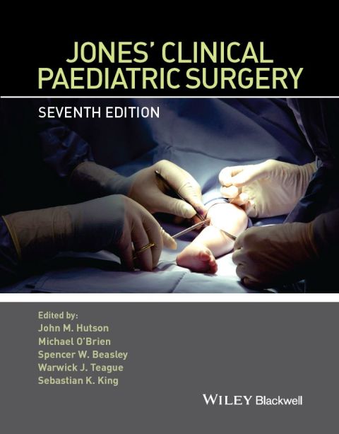 Jones' Clinical Paediatric Surgery 
